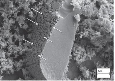 Figure 3: Cryo SEM micrograph of a cement grain sample hydrated for 6 hours with C-S-H seeds from Nicoleau and Bertolim [9]. Etch pits are indicated by white arrows and localized on one plane only.