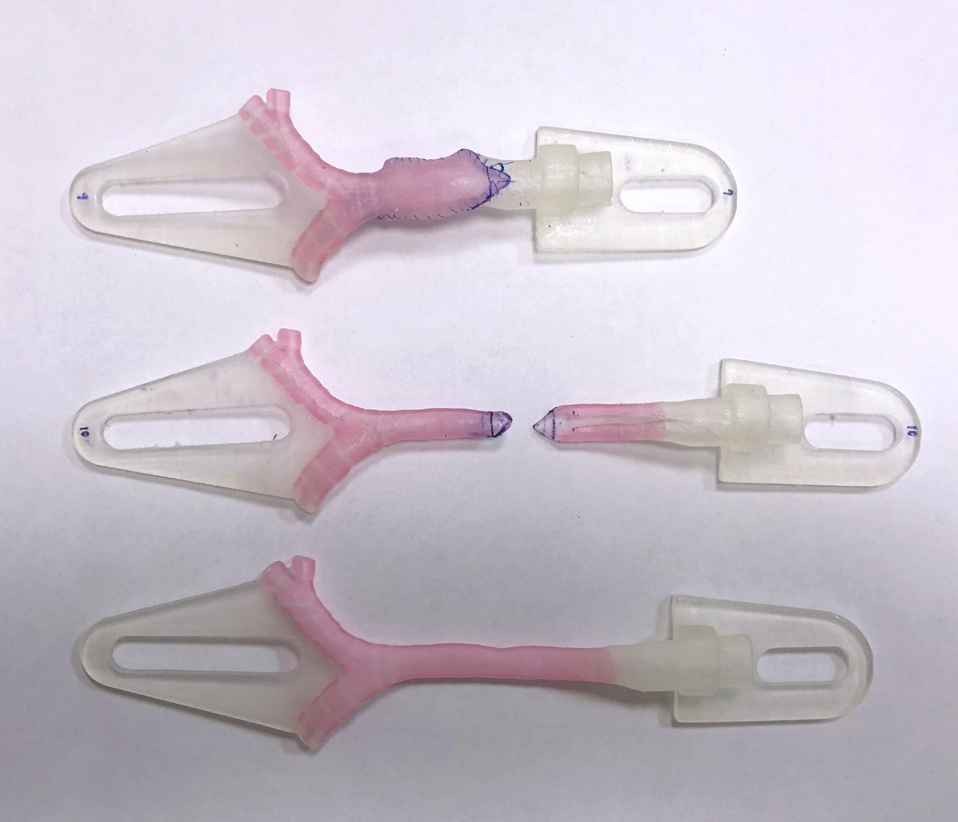 3D-printed models showing virtual surgical planning for a slide tracheoplasty procedure, courtesy Kaalan Johnson, M.D., Seattle Children's Hospital.
