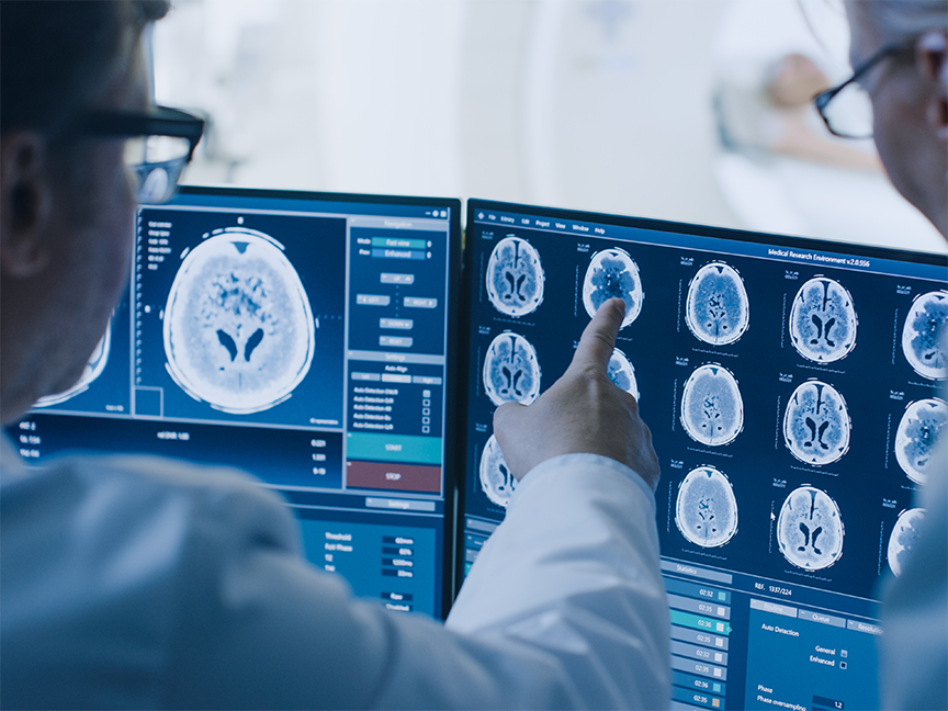A radiologist analyzes CT scans of a patient's brain. Photo: Getty.