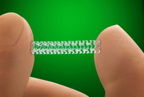 Abbott's New Absorb Stent / Photo: PR NEWSWIRE