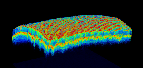 Optical coherence tomography angiography / Image: medgadget