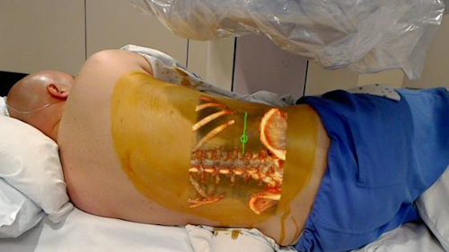 Medical Augmented Reality / Image: Novarad