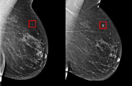 Breast Exam / Image: TechCrunch