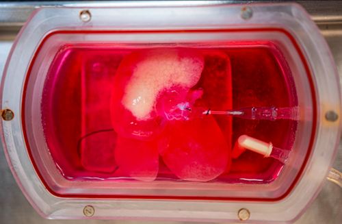 Mini Liver / Image: UPMC