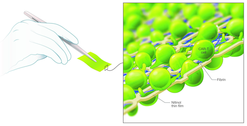 T Cell Mesh