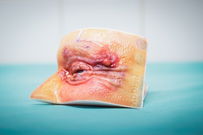 Anatomic models, like the one shown, are being created and used for advanced surgical education, training and surgical planning to boost the skill sets of medical professionals and improve patient outcomes.