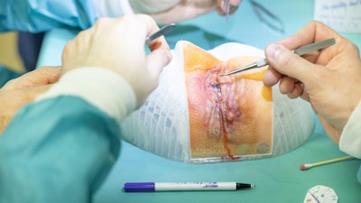 Addion Dap Eyelid Image 2